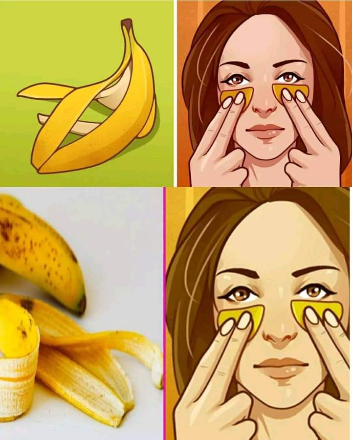 Do not throw away Banana Peels Here are 7 Essential Uses